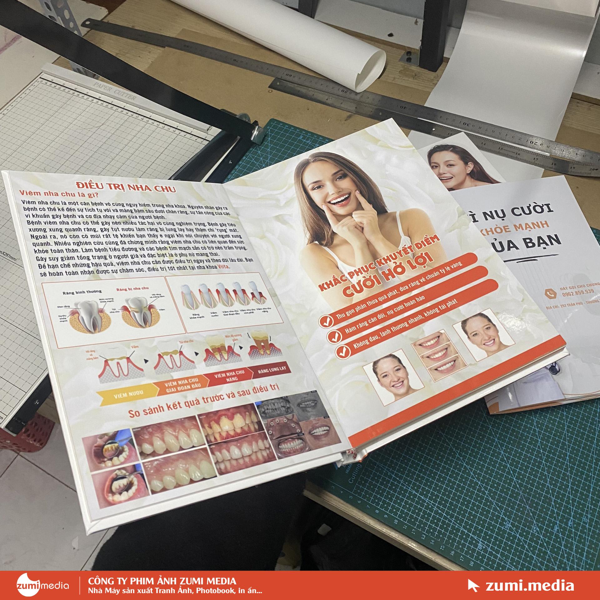 In Menu Photobook Nha Khoa Vita Long An 3 In Menu Photobook Nha Khoa Vita Long An 1