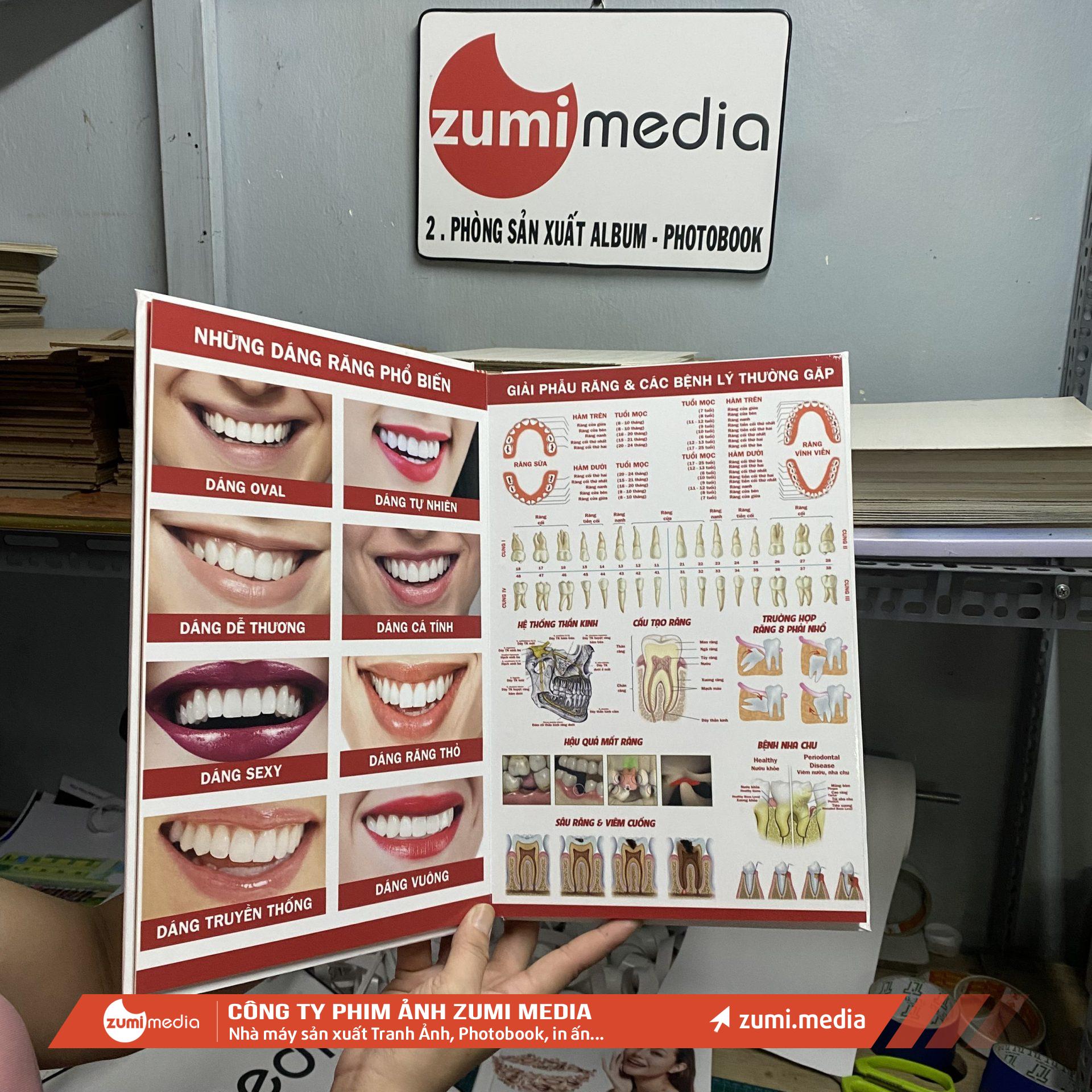 In sách Menu Photobook Nha Khoa Thẩm Mỹ Quốc tế 3 In sach Menu Photobook Nha Khoa Tham My Quoc te 2